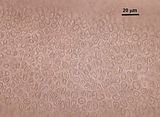 4 – Cellule corticali in visione superficiale